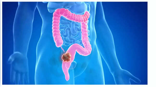 Image representing rapid weight loss