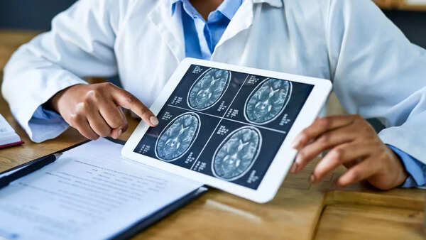 Illustration of a human brain